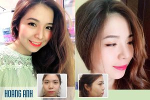 lorem ipsum dolor sit amet lorem ipsum dolor sit amet